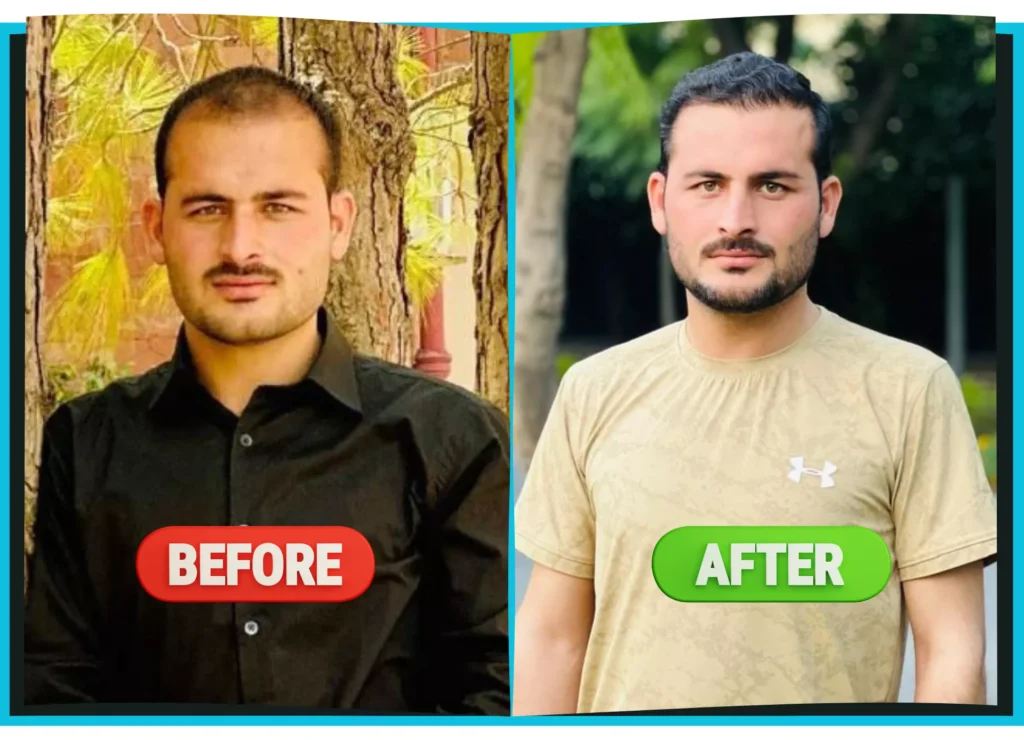 hiarXpert_clinic_results_before_and_after_image01