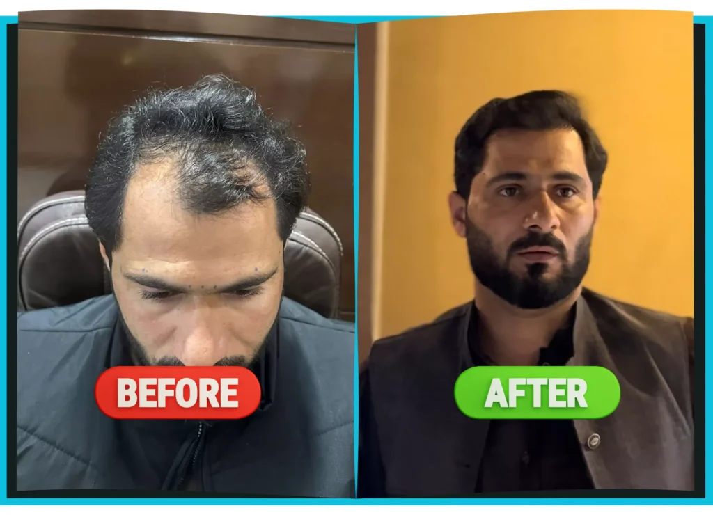 hiarXpert_clinic_results_before_and_after_image02