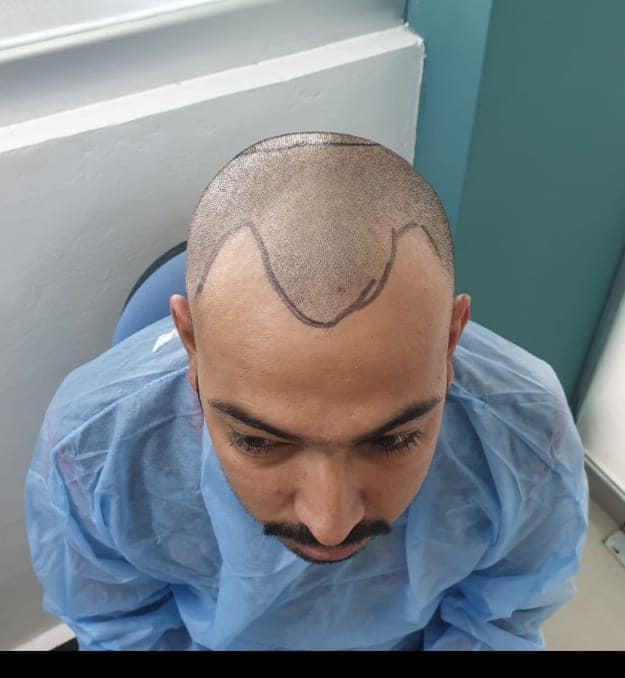 Patients_Reviews_HairXpert_Clinic_01