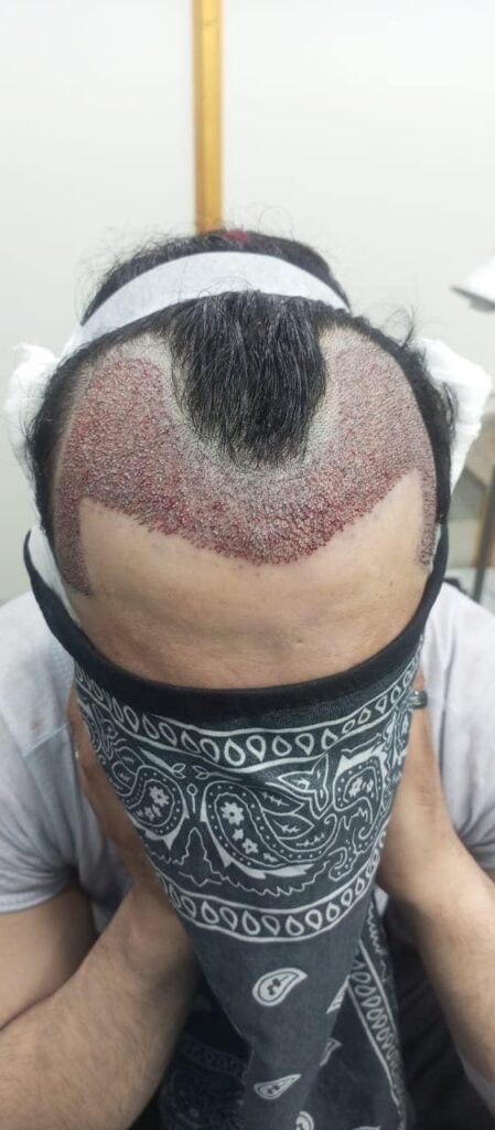 Patients_Reviews_HairXpert_Clinic_04