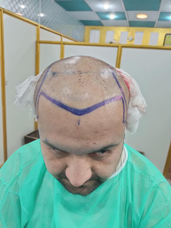 Patients_Reviews_HairXpert_Clinic_03