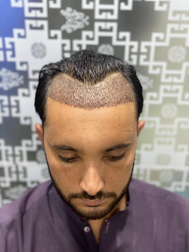 Patients_Reviews_HairXpert_Clinic_02