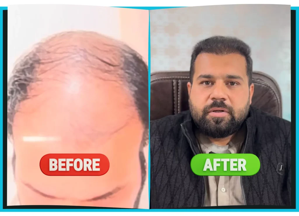 hiarXpert_clinic_results_before_and_after_image06