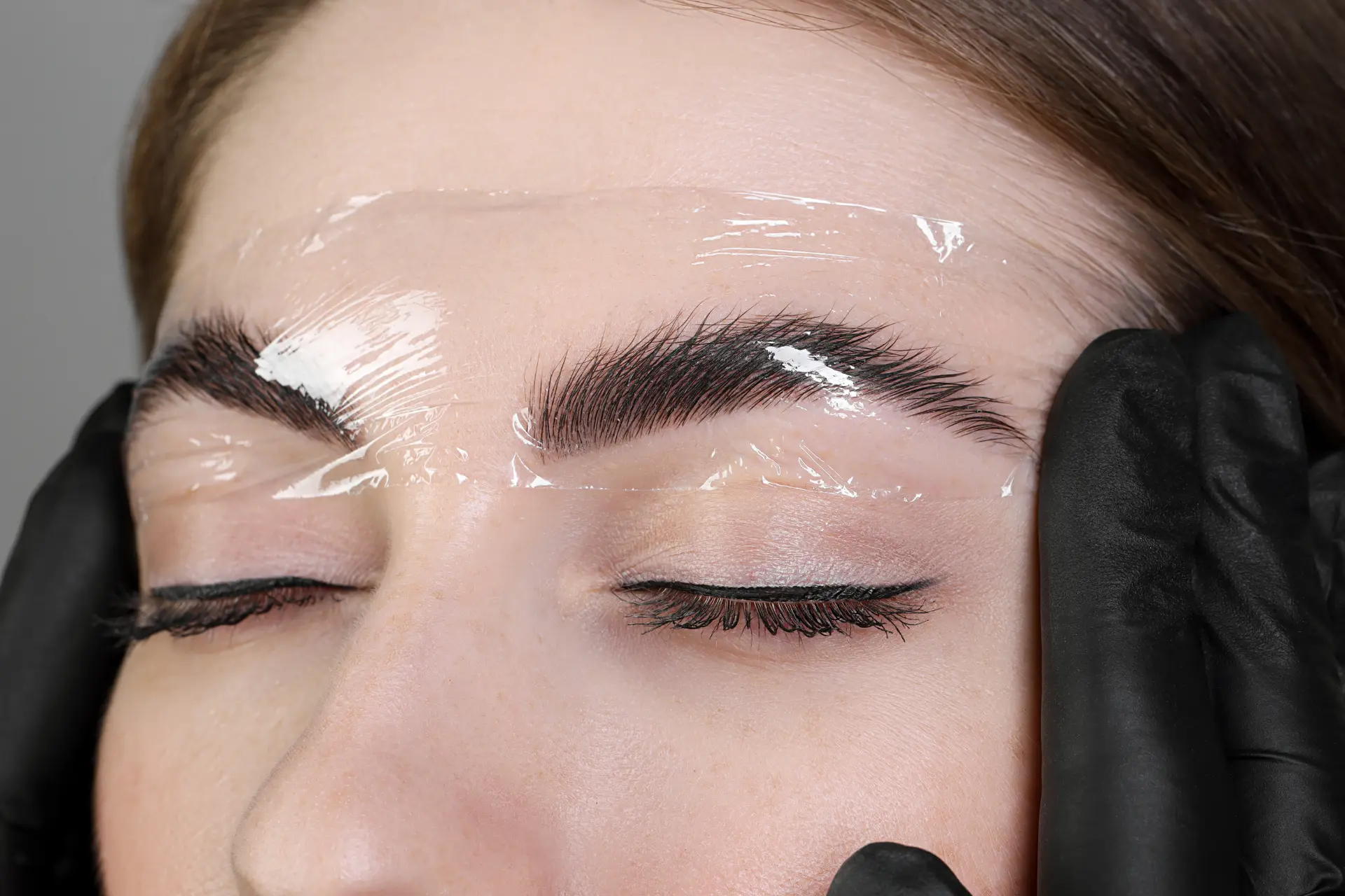 brow lift