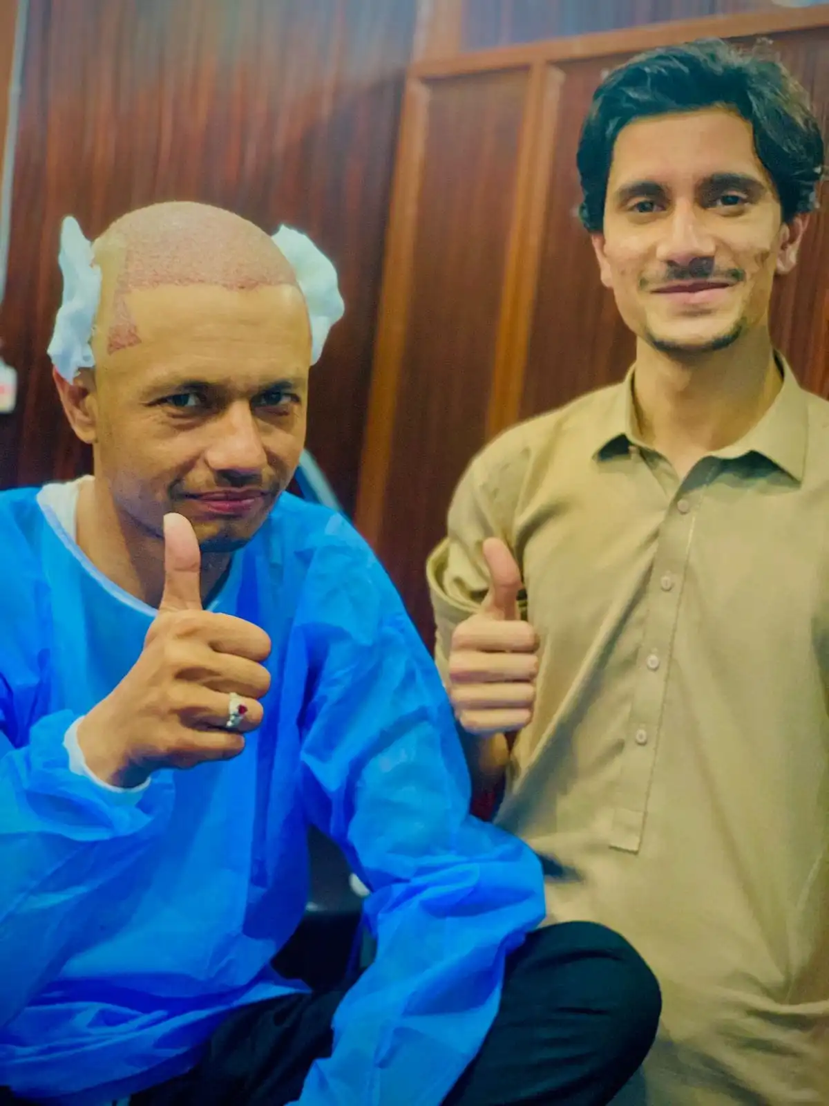 FUT Hair Transplant in Peshawar 1 What_is_FUT_Hair_Transplant?