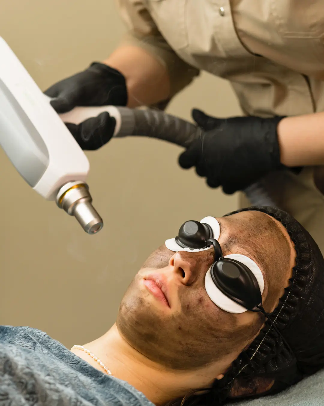 Black Carbon Laser Treatment 1 black corbon