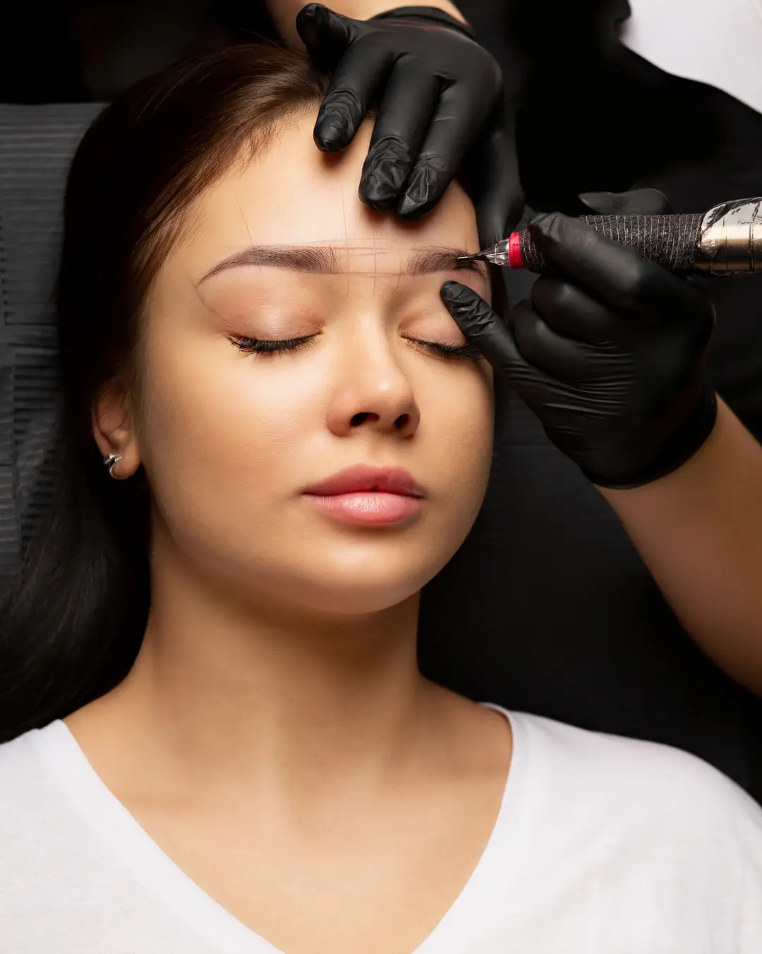 brow lift